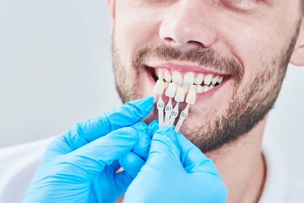 Esthetic Dentistry - What it is, Types, and What to Expect