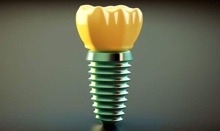 Icon White Spot Treatment at Riverbend family dentistry in Jupiter